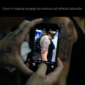 Cenik odstranjevanja tetovaž